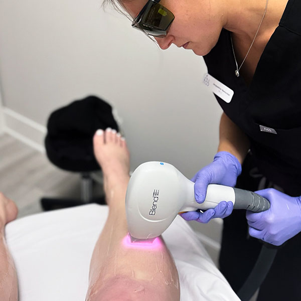 Laser Hair Removal Treatment Performed On Patient Leg